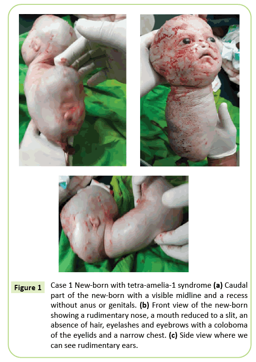 gynecology-obstetrics-rudimentary